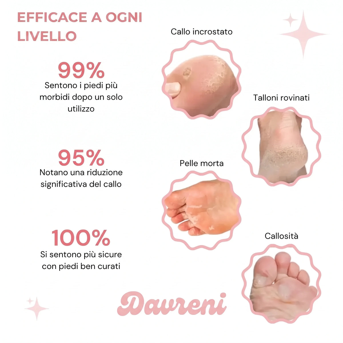 ✨ Davreni™ – Kit pedicure elettrico