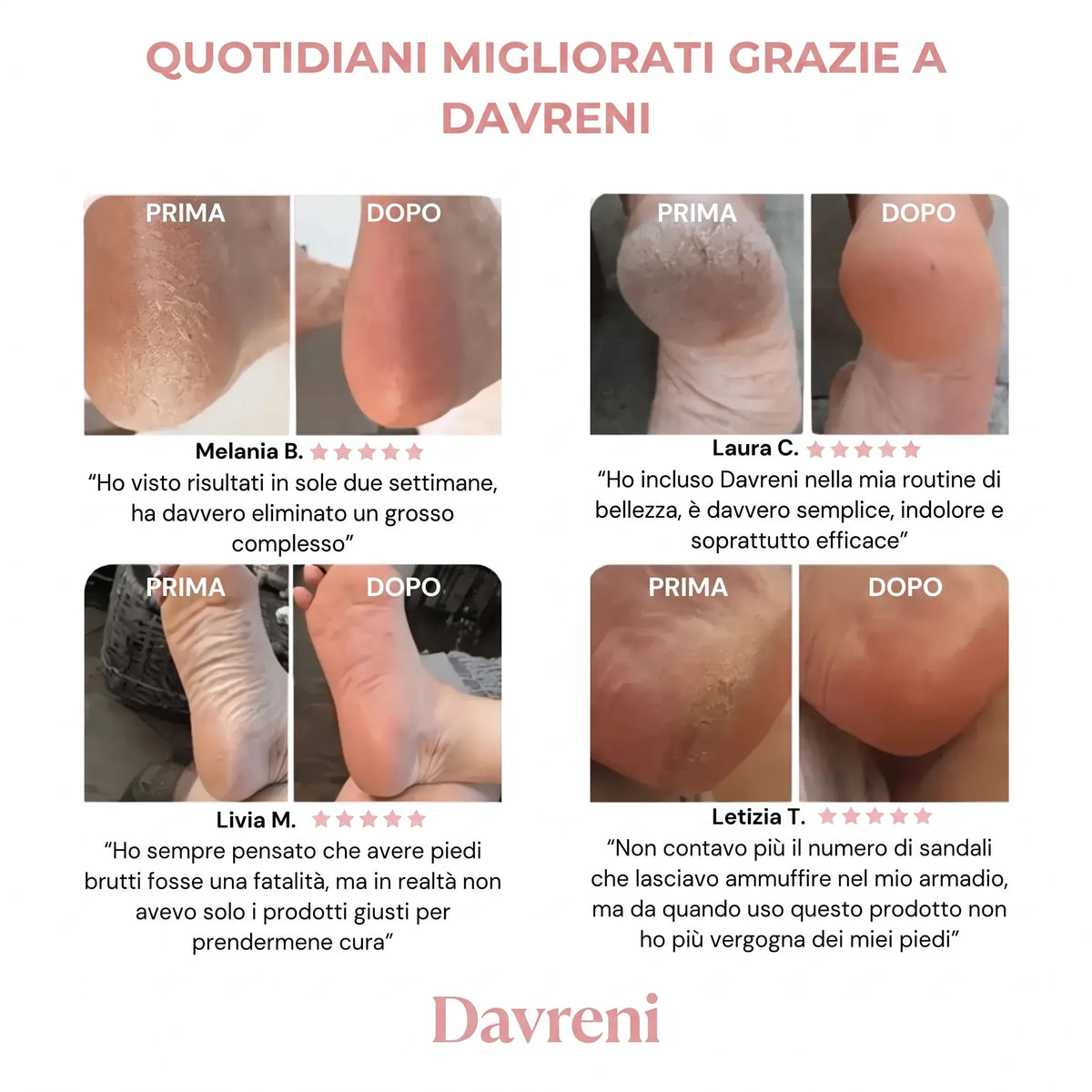 ✨ Davreni™ – Kit pedicure elettrico