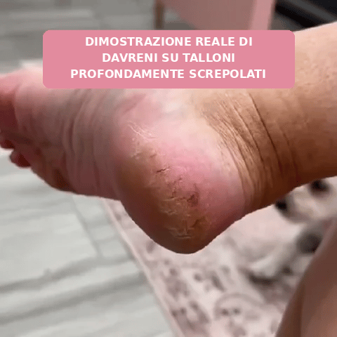 ✨ Davreni™ – Kit pedicure elettrico